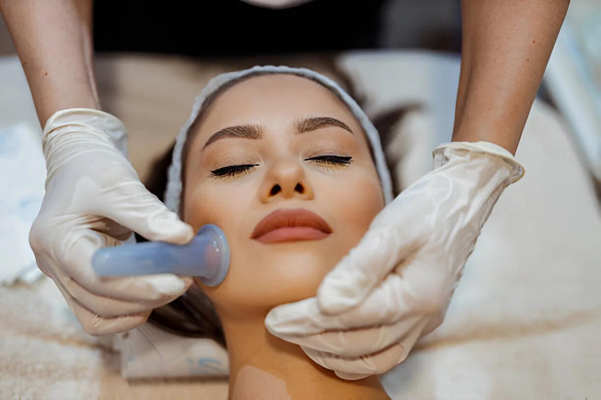 Is Facial Cupping Safe for Every Skin Type